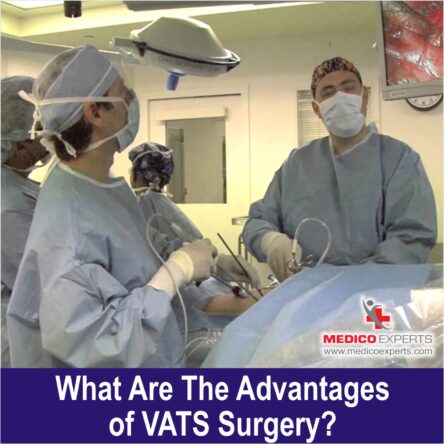 vats surgery | MedicoExperts