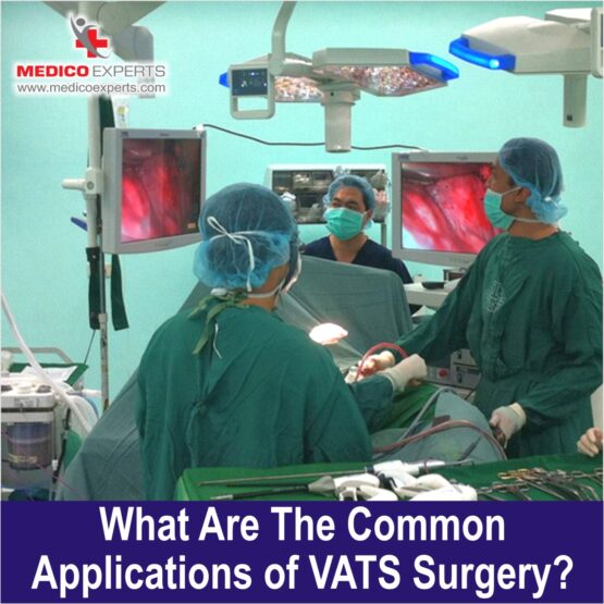 VATS Surgery