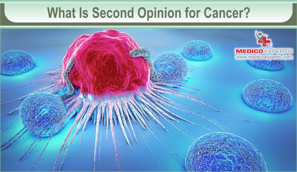 cancer second opinion