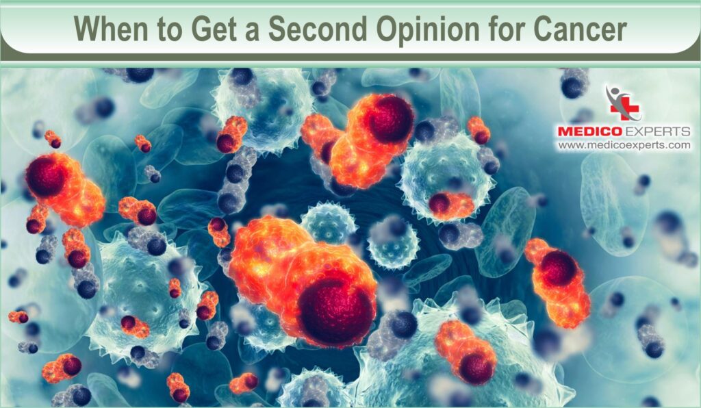 cancer second opinion | MedicoExperts