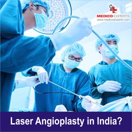 laser angioplasty in India