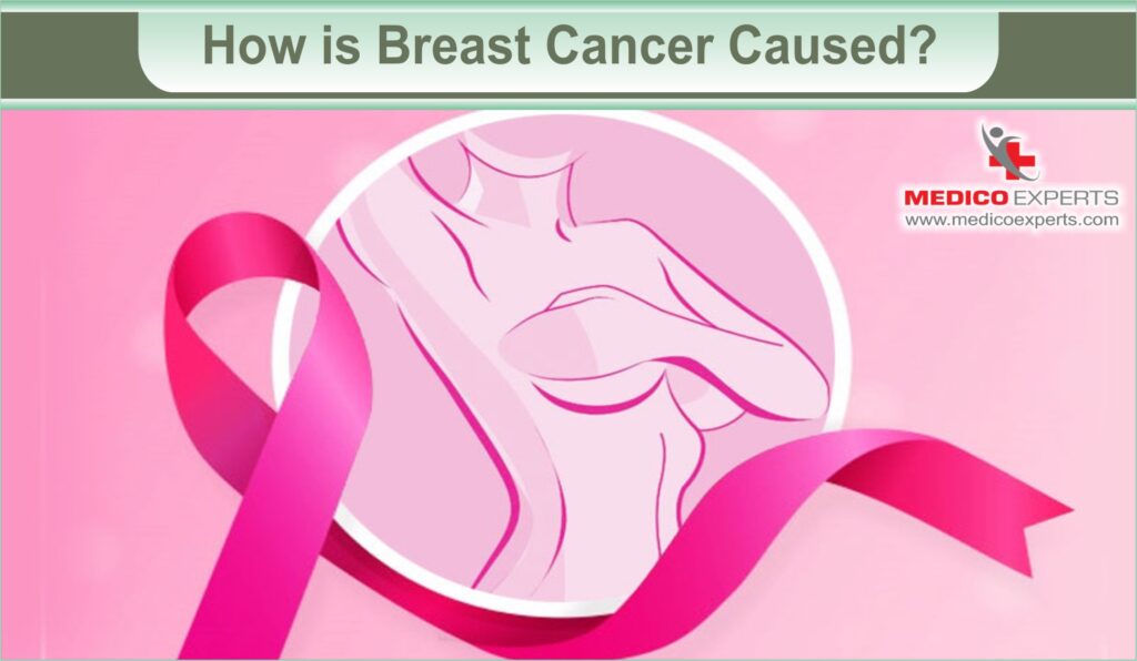 how urgent is breast cancer surgery | MedicoExperts