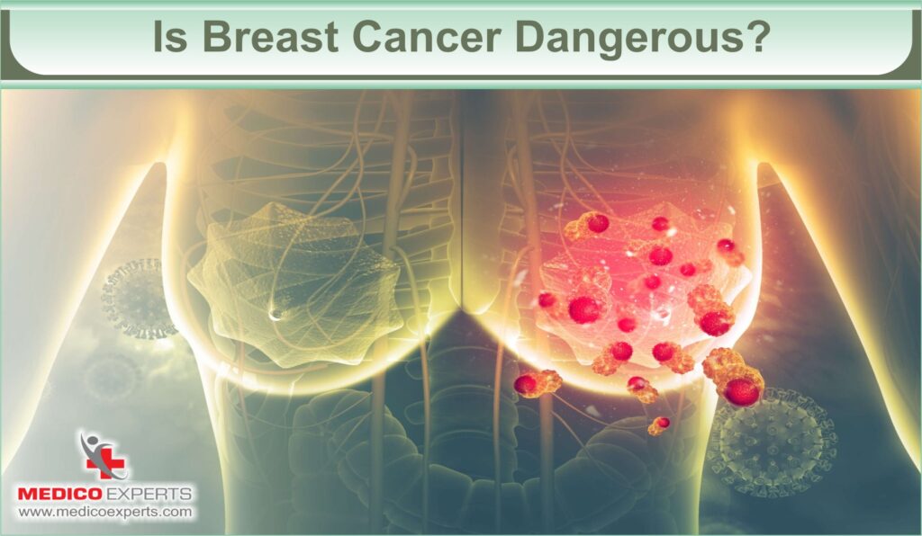 how urgent is breast cancer surgery | MedicoExperts