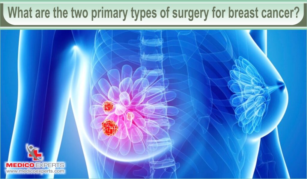 how urgent is breast cancer surgery | MedicoExperts