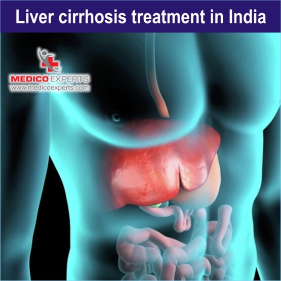 Liver Cirrhosis Treatment in india