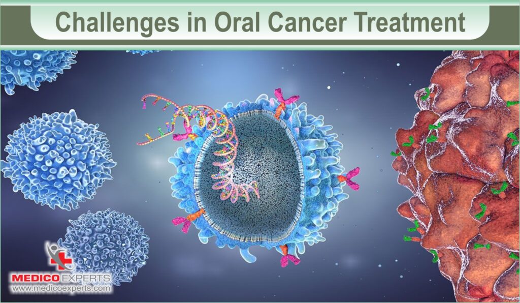 Tumor Board Approach