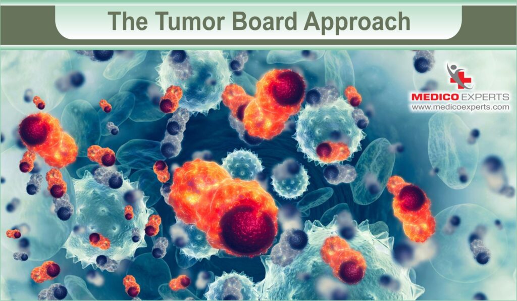 Tumor Board Approach | MedicoExperts