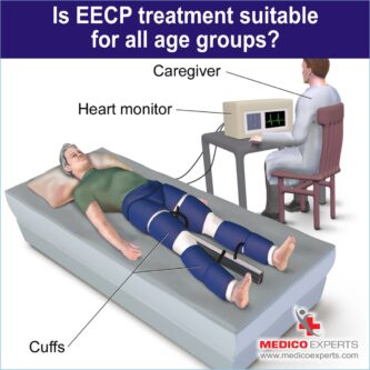 eecp treatment