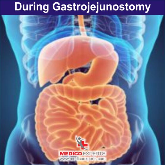 During Gastrojejunostomy