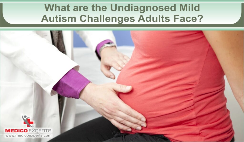 mild autism in adults treatment