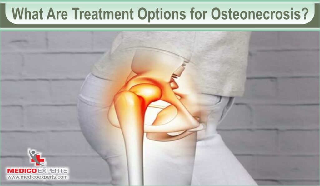 Osteonecrosis Treatments | MedicoExperts