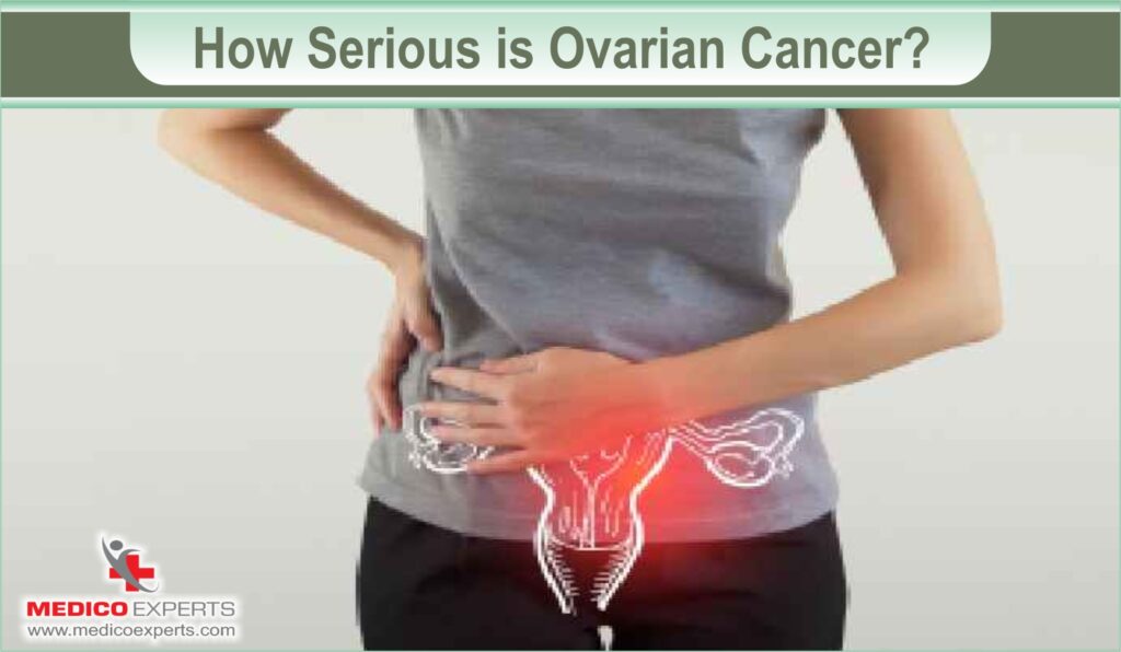 is ovarian cancer treatable