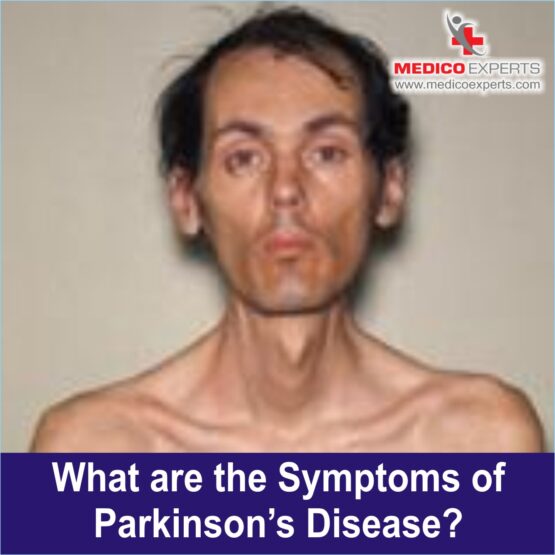 symptoms of Parkinson's disease