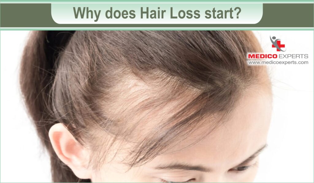 ayurvedic treatment for hair loss and regrowth | MedicoExperts