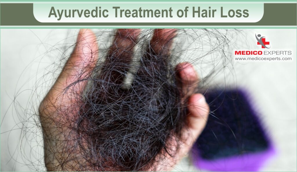 ayurvedic treatment for hair loss and regrowth | MedicoExperts