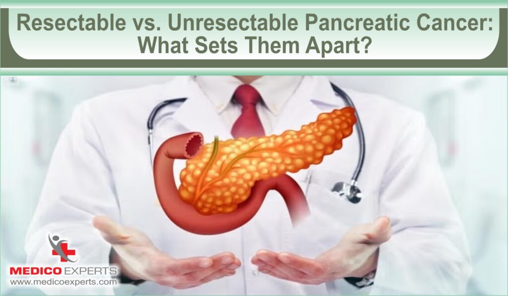 Is Pancreas Cancer Treatable? Your Treatment Roadmap