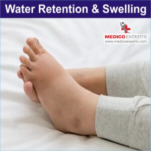 water retention