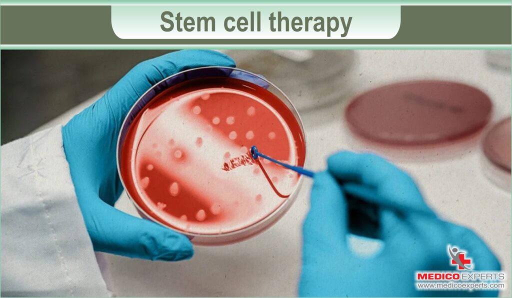 Stem Cell Therapy