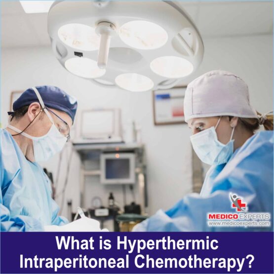 What is Hyperthermic Intraperitoneal Chemotherapy?