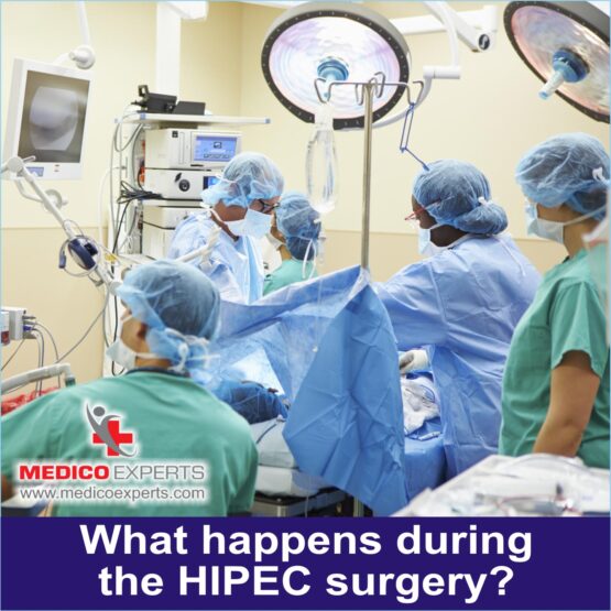 What happens during the HIPEC surgery?