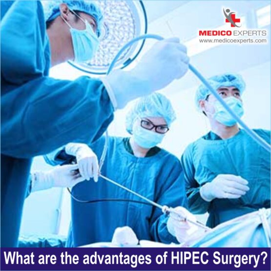 What are the advantages of HIPEC Surgery?