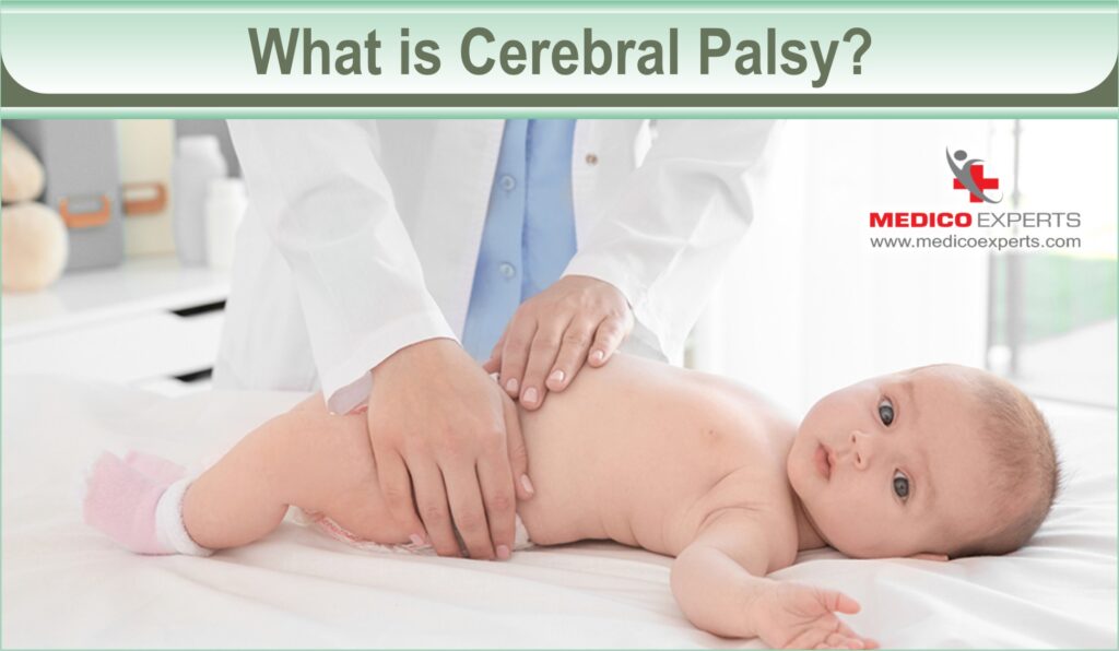 What is Cerebral Palsy?