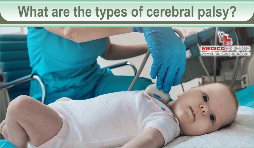 What are the types of cerebral palsy?