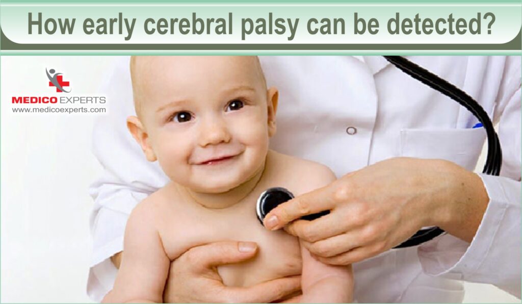 How early cerebral palsy can be detected?