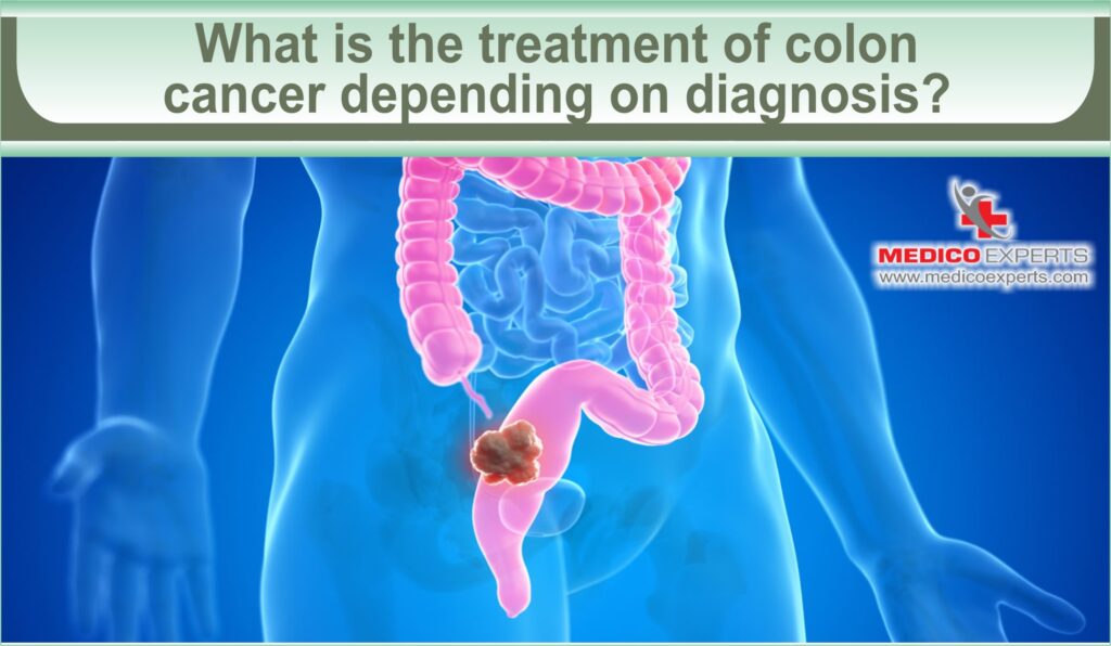 What is the treatment of colon cancer depending on diagnosis?