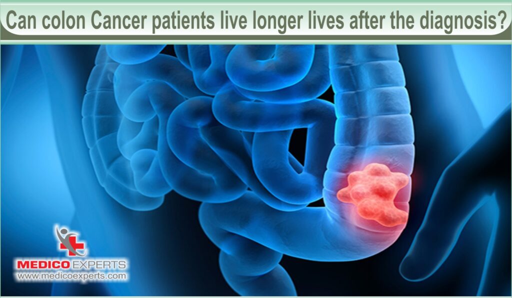 Can colon cancer patients live longer lives after the diagnosis?