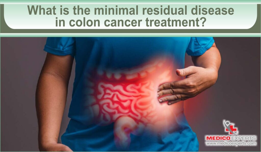 What is the minimal residual disease in colon cancer treatment?