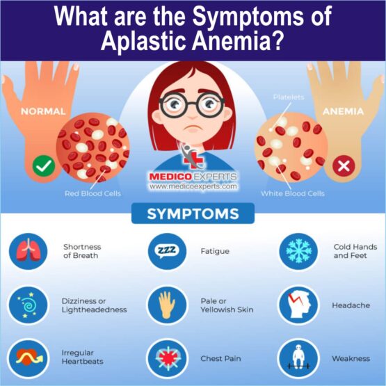 What are the symptoms of Aplastic Anemia?