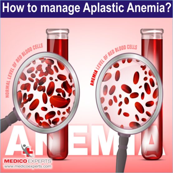 How to manage Aplastic Anemia?