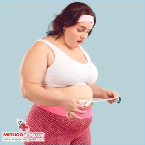 Bariatric Surgery Treatment