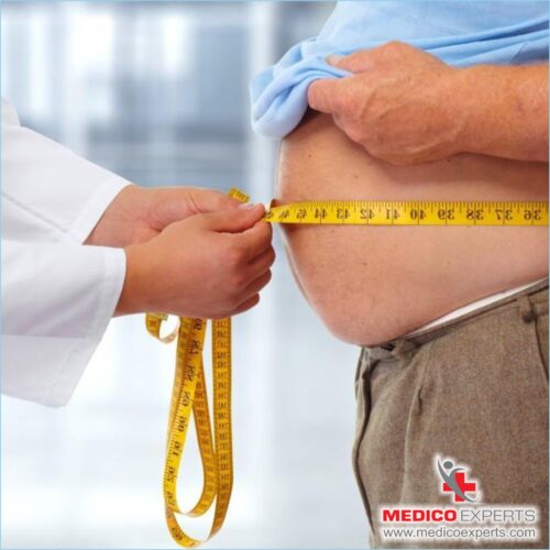 Bariatric Surgery