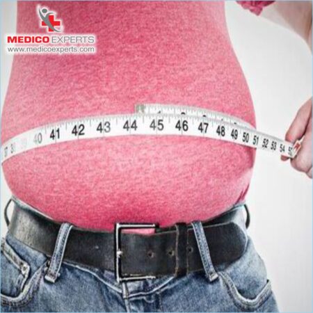 Weight management through Bariatric Surgery