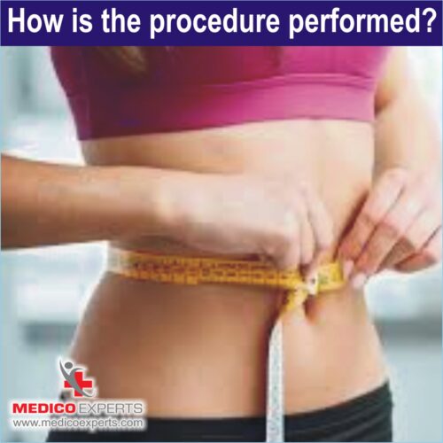 How is procedure performed