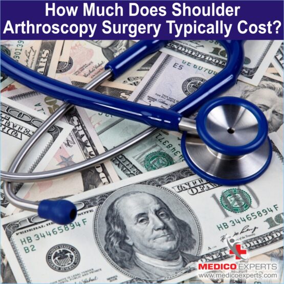 How much does Shoulder Arthroscopy Surgery typically cost?