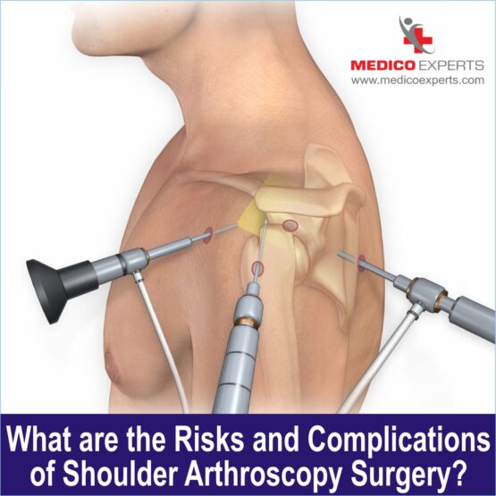 What are the risks and complications of Shoulder Arthroscopy Surgery?