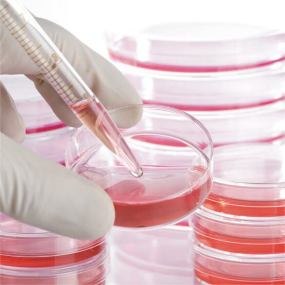 Stem Cell Therapy for Chronic Kidney Disease