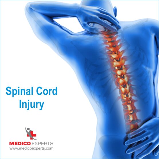 Stem Cell Therapy for Spinal Cord Injury in India