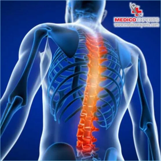 How are spinal cord injuries diagnosed? Stem Cell Therapy in India for Spinal Cord Injury