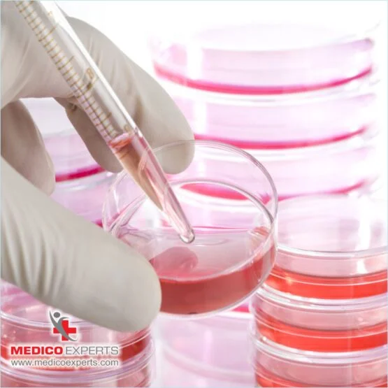 Stem Cell Therapy for Spinal Cord Injury in India Stem cell treatment for spinal cord injury Cost of stem cell therapy