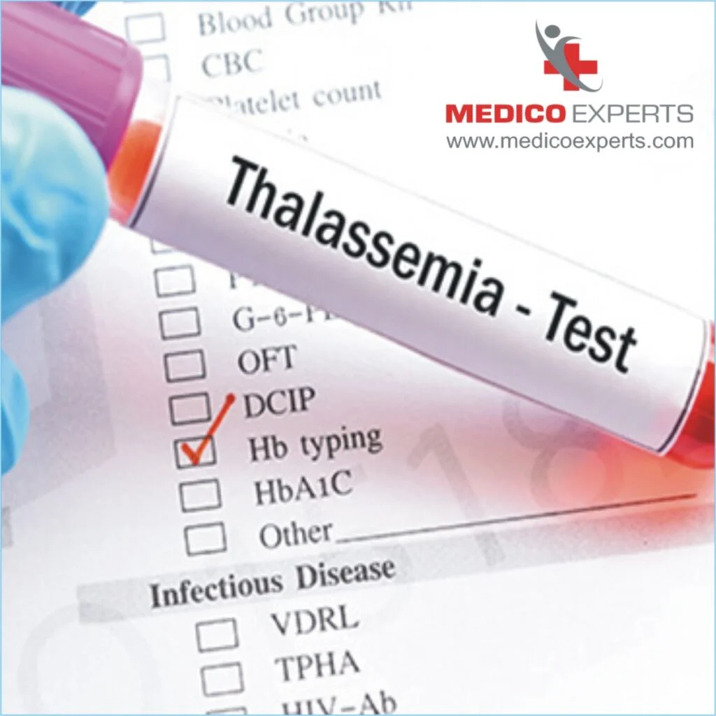 What is the diagnostic test for Thalassemia? What happens if I have thalassemia? thalassemia diagnosis test