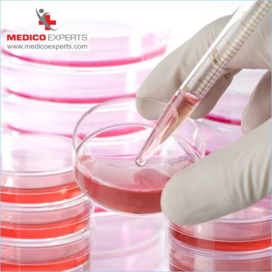 stem cell therapy for autism in mumbai Effectiveness of Stem Cell Therapy for ASD