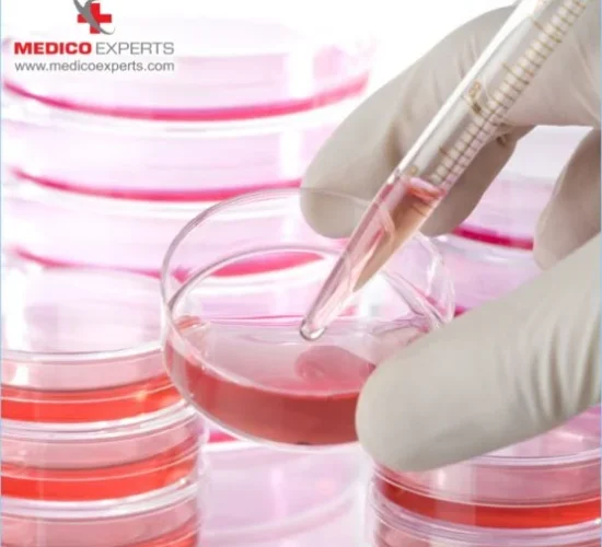 stem cell therapy for cerebral palsy, stem cell treatment for cerebral palsy in india