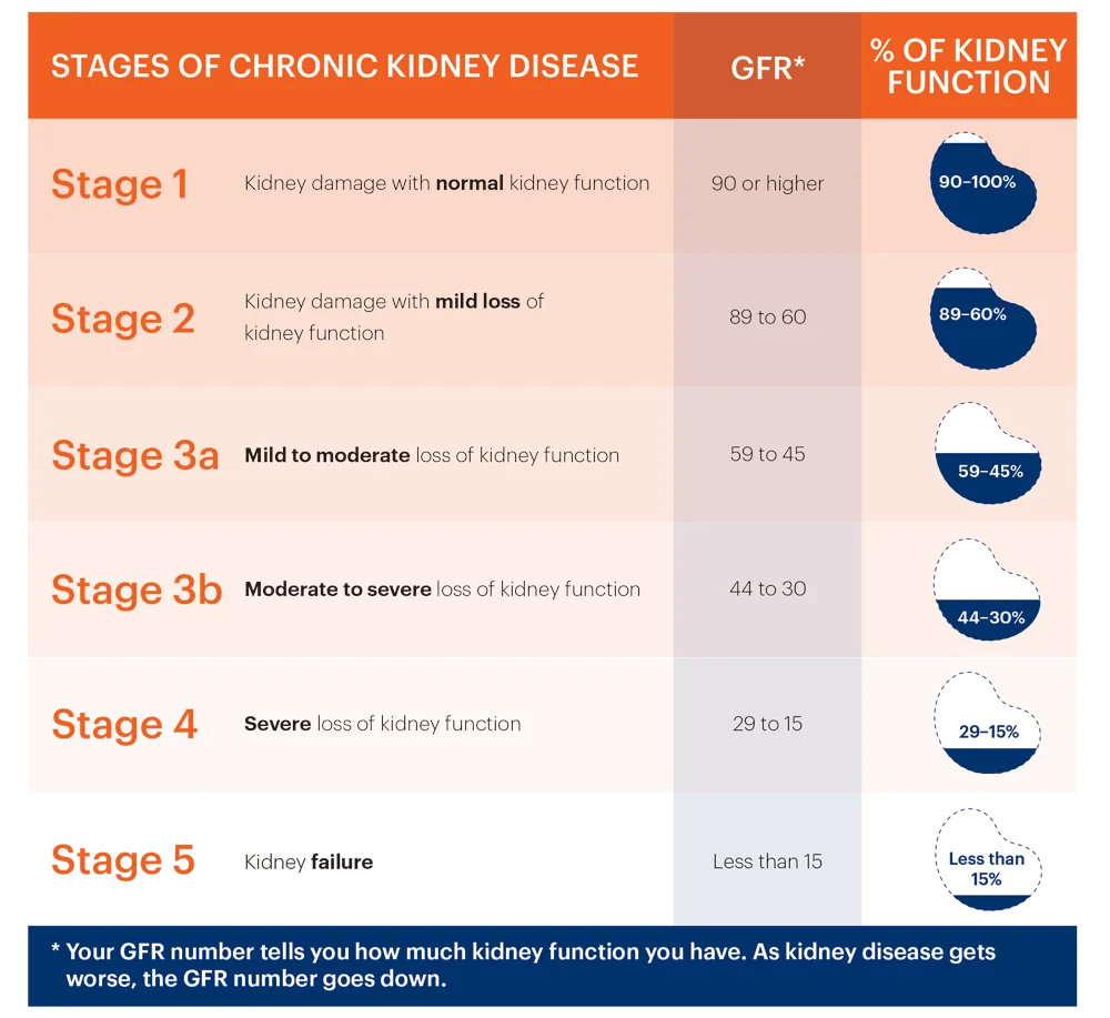 stem cell therapy for chronic kidney disease What are the stages of Chronic Kidney Disease?