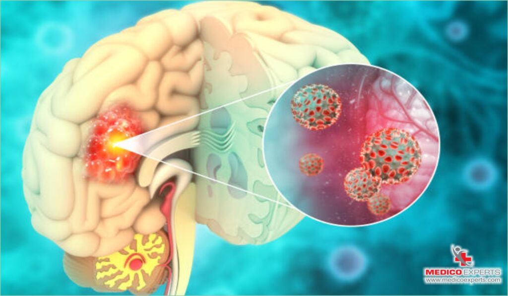 What is Motor Neuron Disease?, can mnd be cured, Is MND a painful disease