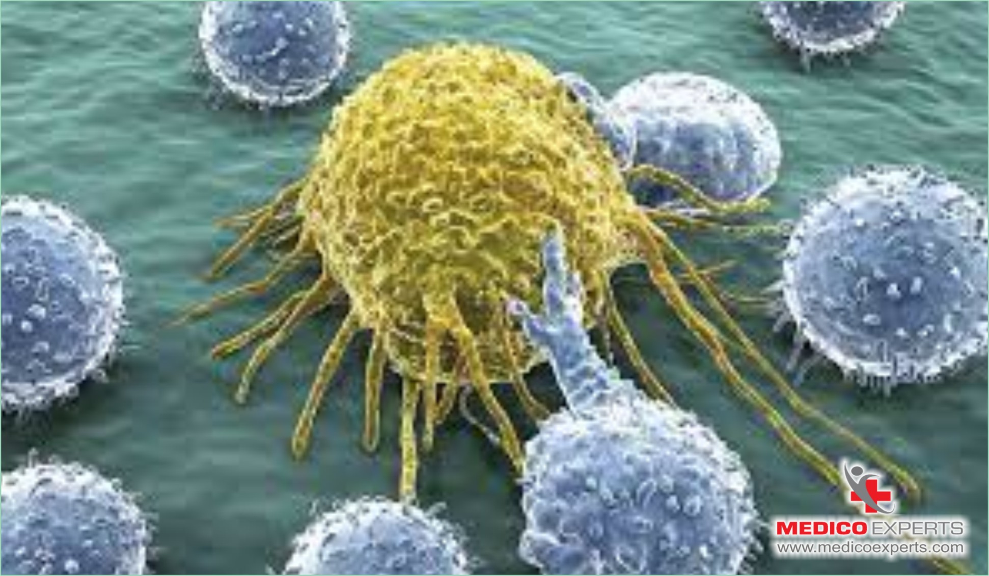 Who is the right candidate for CAR-T Cell Therapy?